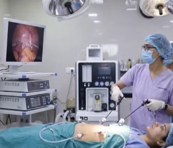 A laparoscopic procedure under way in the operation theatre